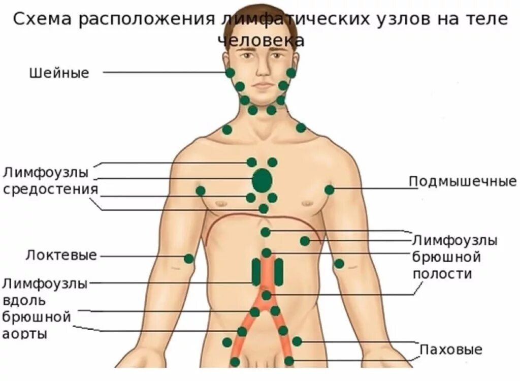 Лимфоузел надпочечнике. Схема лимфоузлов. Схема расположения лимфоузлов на теле человека. Расположение поверхностных лимфатических узлов у человека. Регионарные лимфатические узлы схема.