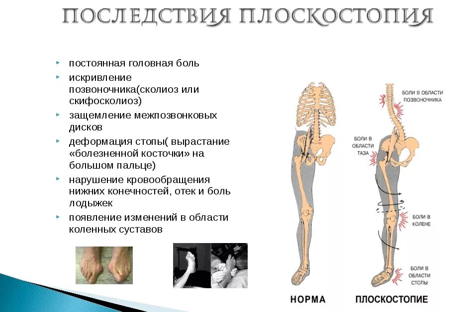 Нарушения развития скелета