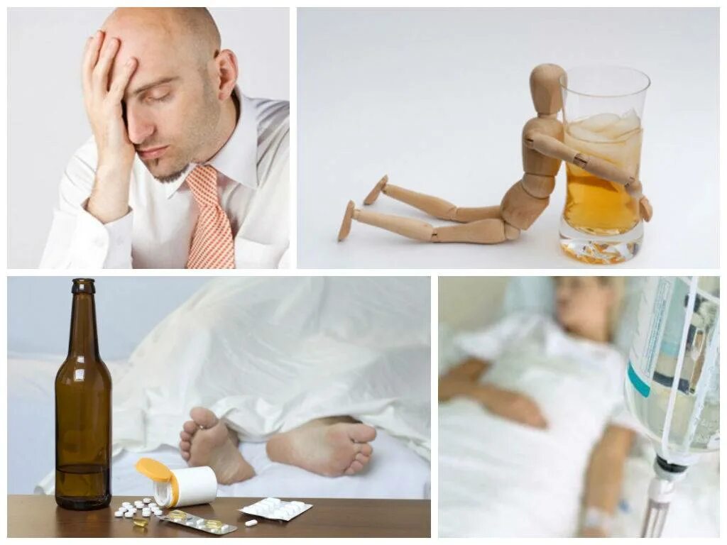 Алкогольный абстинентный синдром, алкогольная интоксикация. Алкогольный абстинентный синдром симптомы. Алкогольное похмелье. Тремор с похмелья