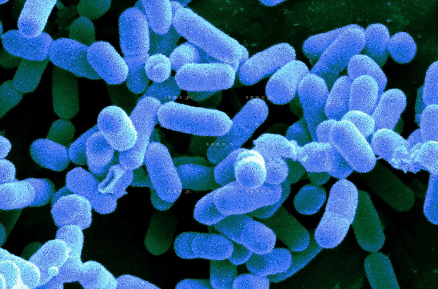 Listeria monocytogenes (листерии). Возбудитель листериоза. Listeria бактерия. Листерии микробиология. Гибриды бактерий