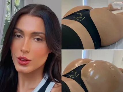 Fernanda Campos faz procedimento para empinar bumbum e cita cuidados: &apos...