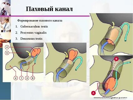 Нижняя стенка пахового канала образована