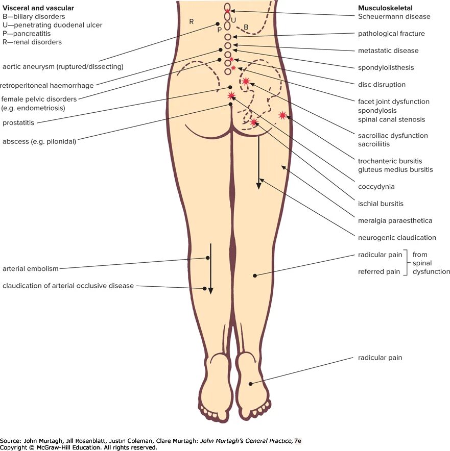 Thigh hip разница. 74. Hip расшифровка. Hips system. Калькулятор типа фигуры по параметрам.