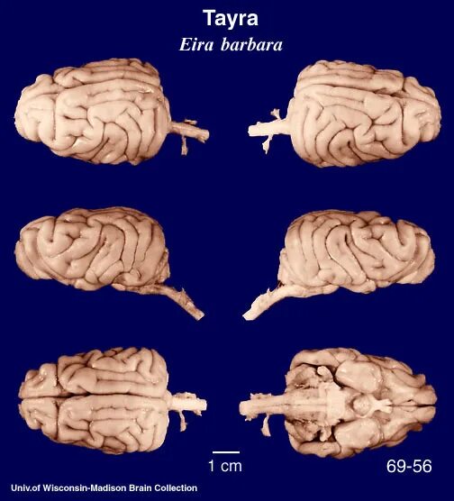 Re brain