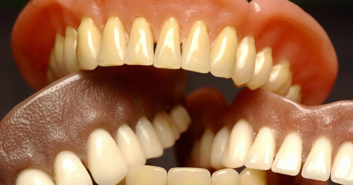 Искусственные зубы. Искусственные зубы для протезов. Пластмассовые искусственные зубы. Зубные протезы из каучука.