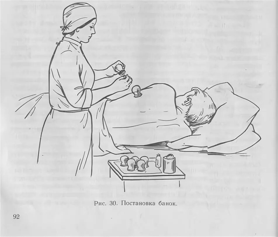 Схема постановки банок. Схема постановки медицинских банок. Схема постановки банок на спину. Можно ставить банки при кашле взрослому