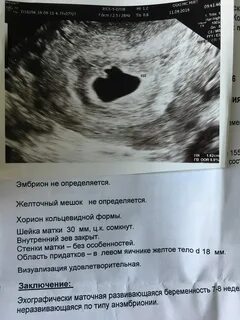 Дата меньше минимальной