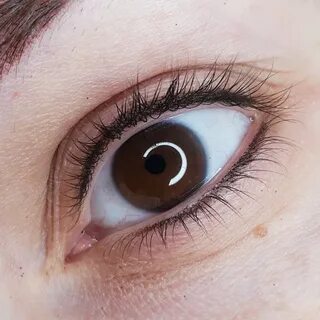 Low eye