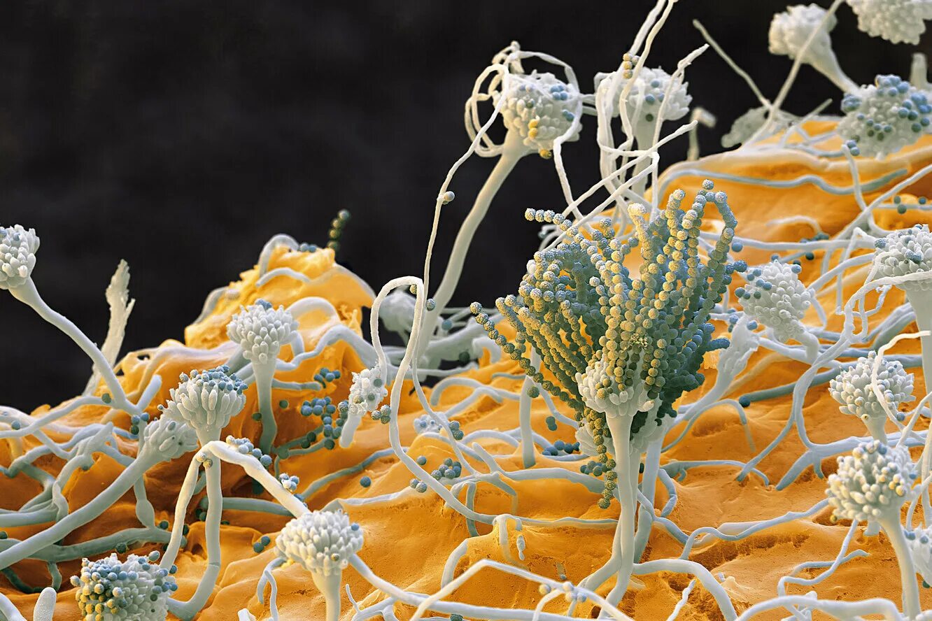 Грибы под микроскопом. Микотоксины penicillium. emericella nidulans. плесневые грибы под микроскопом. мицелий пеницилла под микроскопом.