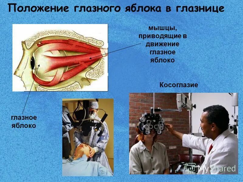 положение глазного яблока