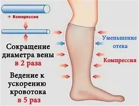 Диаметр вен