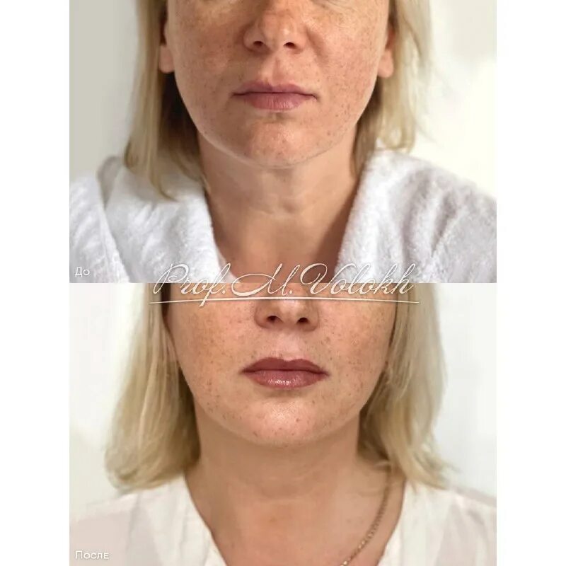 пациентка 45 лет поступила на стационарное. жалобы при субфебрильной температуре. пациентка 45 лет поступила на стационарное. ситуационная задача ибс. пациентка 83 года ситуационная задача.