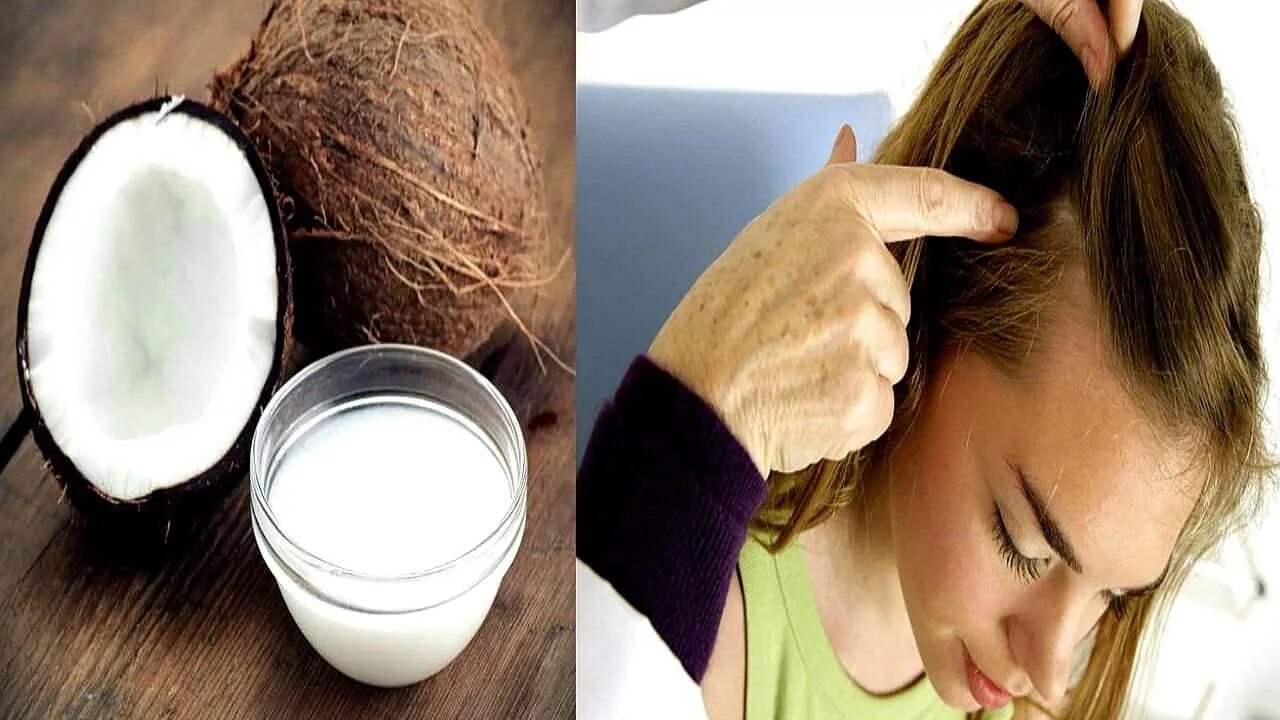 Кокосовое масло для кончиков волос. Кокосовое масло от перхоти. Аллергия на кокосовое масло. Испорченное кокосовое масло. Маску на грязные или чистые волосы