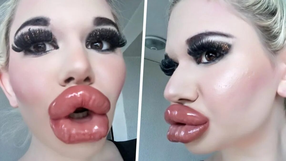 Большие губы как называется. Большие губы как называется. Большие губы как называется. Большие губы как называется. Муклы дягилева.