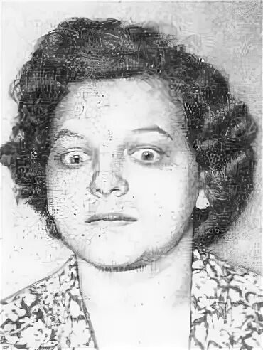 Положительный симптом грефе. Синдром грефе у младенцев. Симптом грефе у новорожденных. Симптом щаходящего солнце. Симптом грефе.