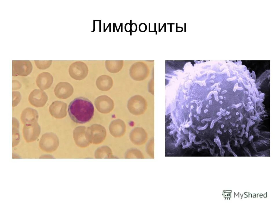 Лимфоциты структура. Лимфоциты. Лимфоциты человека. Лимфоцит рисунок. B-лимфоциты.