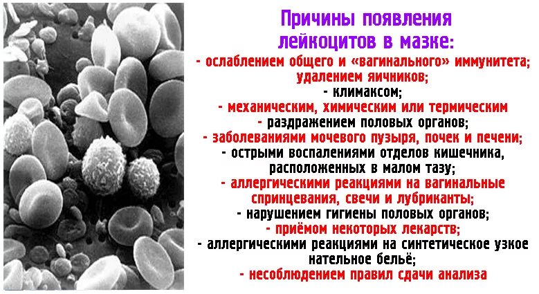 Повышение количества лейкоцитов в мазке. Высокие лейкоциты в мазке. Лейкоцв повышены в мазке. Лейкоциты в мазке у женщин. Лейкоциты в п з