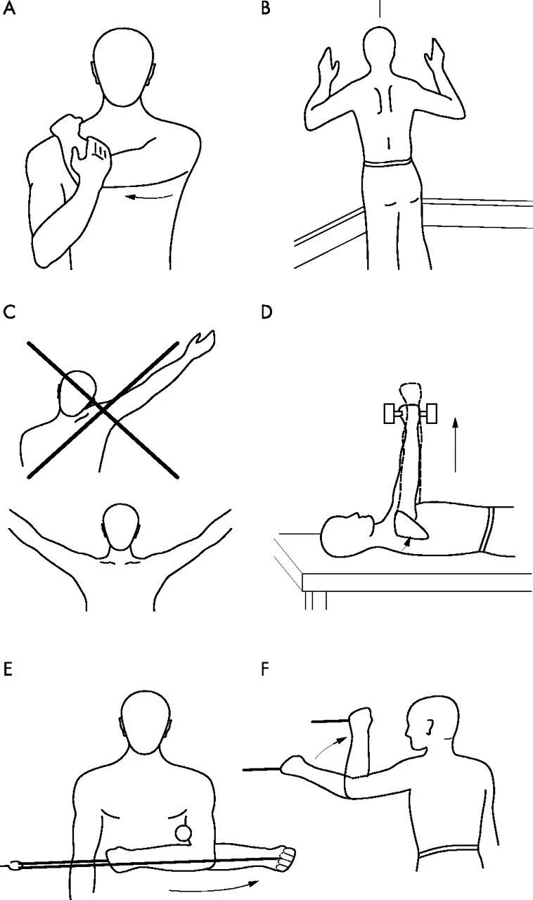 Лечебная гимнастика для плечевого сустава после перелома. Вывих плечевого сустава ЛФК. ЛФК при контрактуре плечевого сустава схемы. ЛФК плечелопаточный периартрит плечевого сустава. Как разработать руку после операции