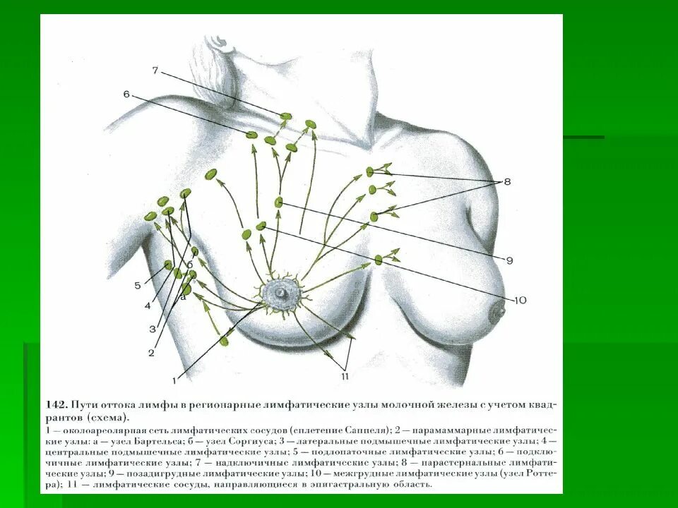 Лимфоузлы при рмж. ЛИМФОУЗЛЫПОДМЫШЕЧНЫЕ ренионарные. Регионарные лимфоузлы молочных желез. Регионарные подключичные лимфоузлы. Лимфатические узлы молочной железы анатомия.