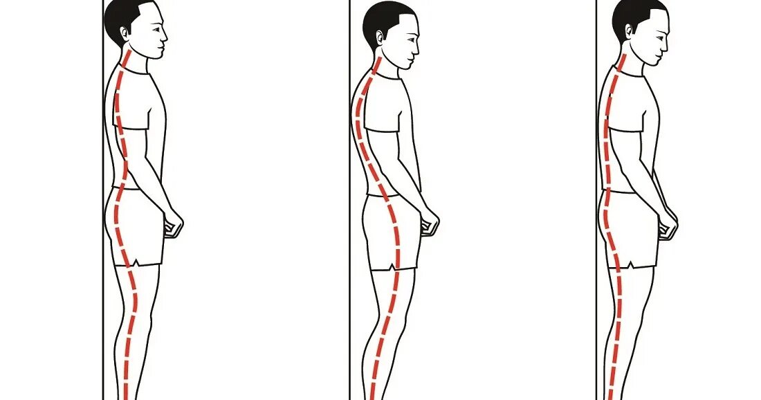 Осанка. Правильная осанка. Проверить осанку. Ровная спина. Опускать насколько