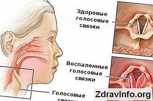 Молчание голосовые связки Shtampik.com