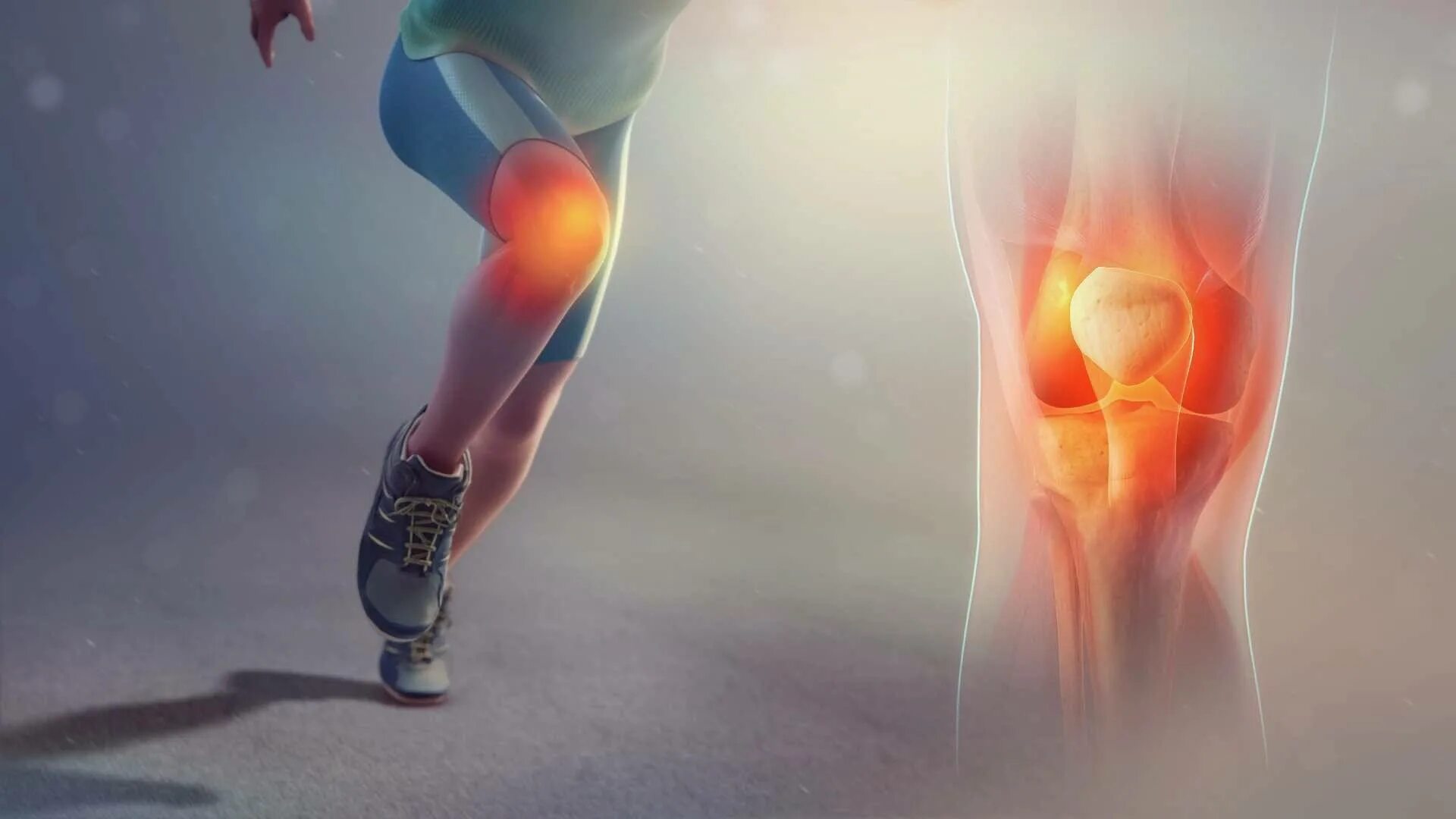 Боли в связках суставов. Knee Joint Pain. Боль в суставах. Болит колено.