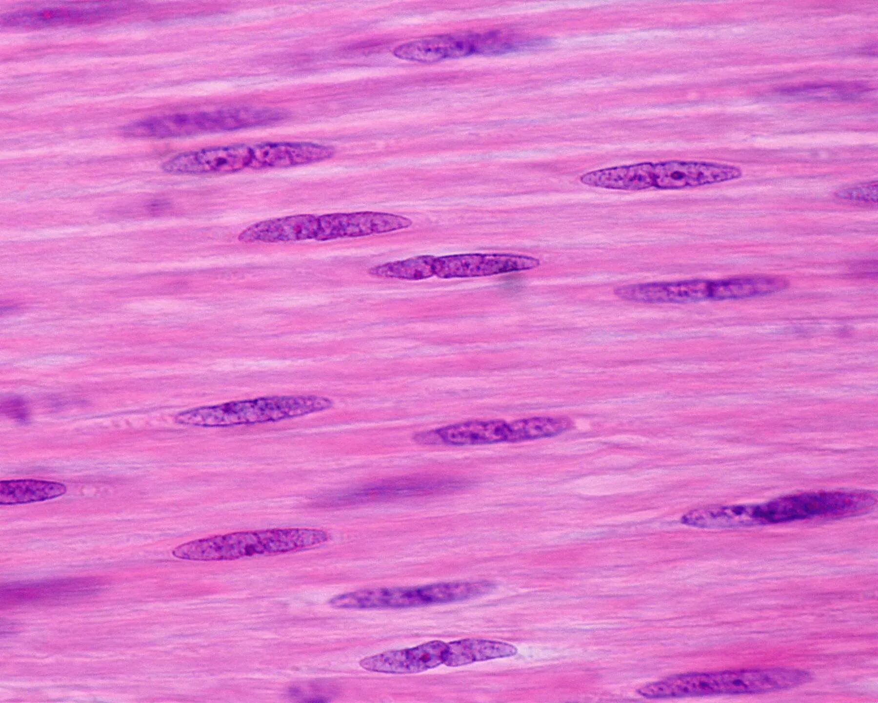 Веретеновидные клетки. Гладкие мышцы под микроскопом. Клетки исчерченные. Короткие веретеновидные клетки. Сильно вытянутые клетки