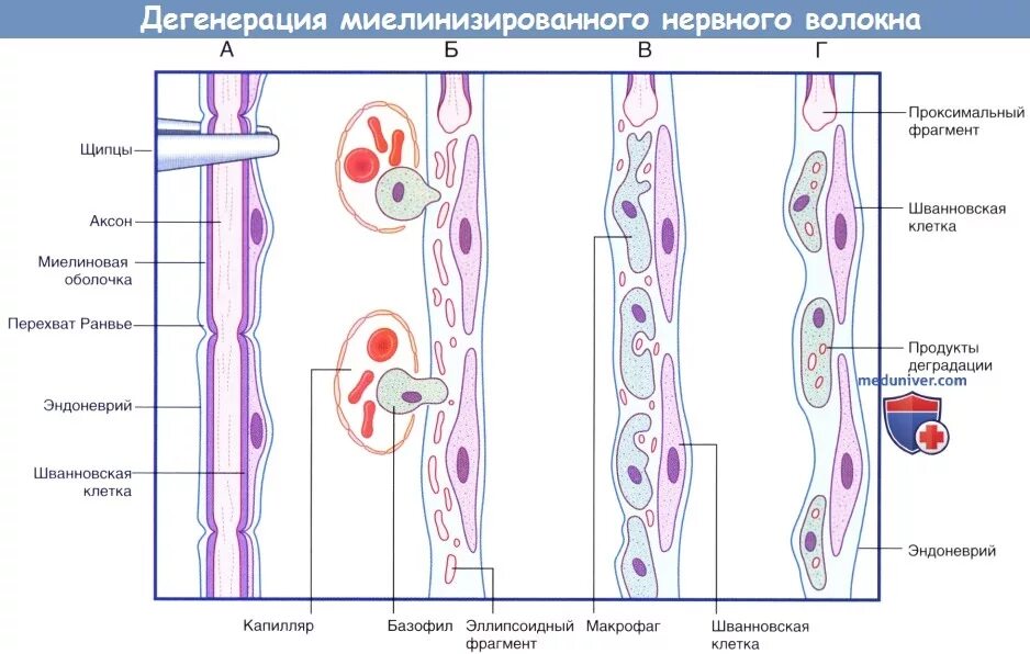 Миелинизация и регенерация нервных волокон. Регенерация нерва гистология. Регенерация нервных волокон гистология. Дегенерация периферического нервного волокна..