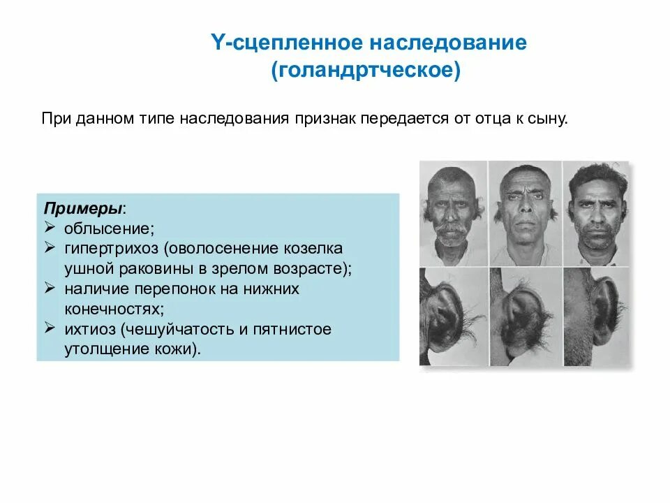 У сцепленный Тип наследования. Признаки y сцепленного типа наследования. Признаки наследования, сцепленного с y-хромосомой. Сцепленный с у хромосомой Тип наследования.