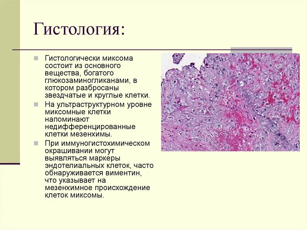 Гистологическое строение опухолей эндометрия. Л система гистология. Анализ крови гистология препарат. Гистологическая характеристика.