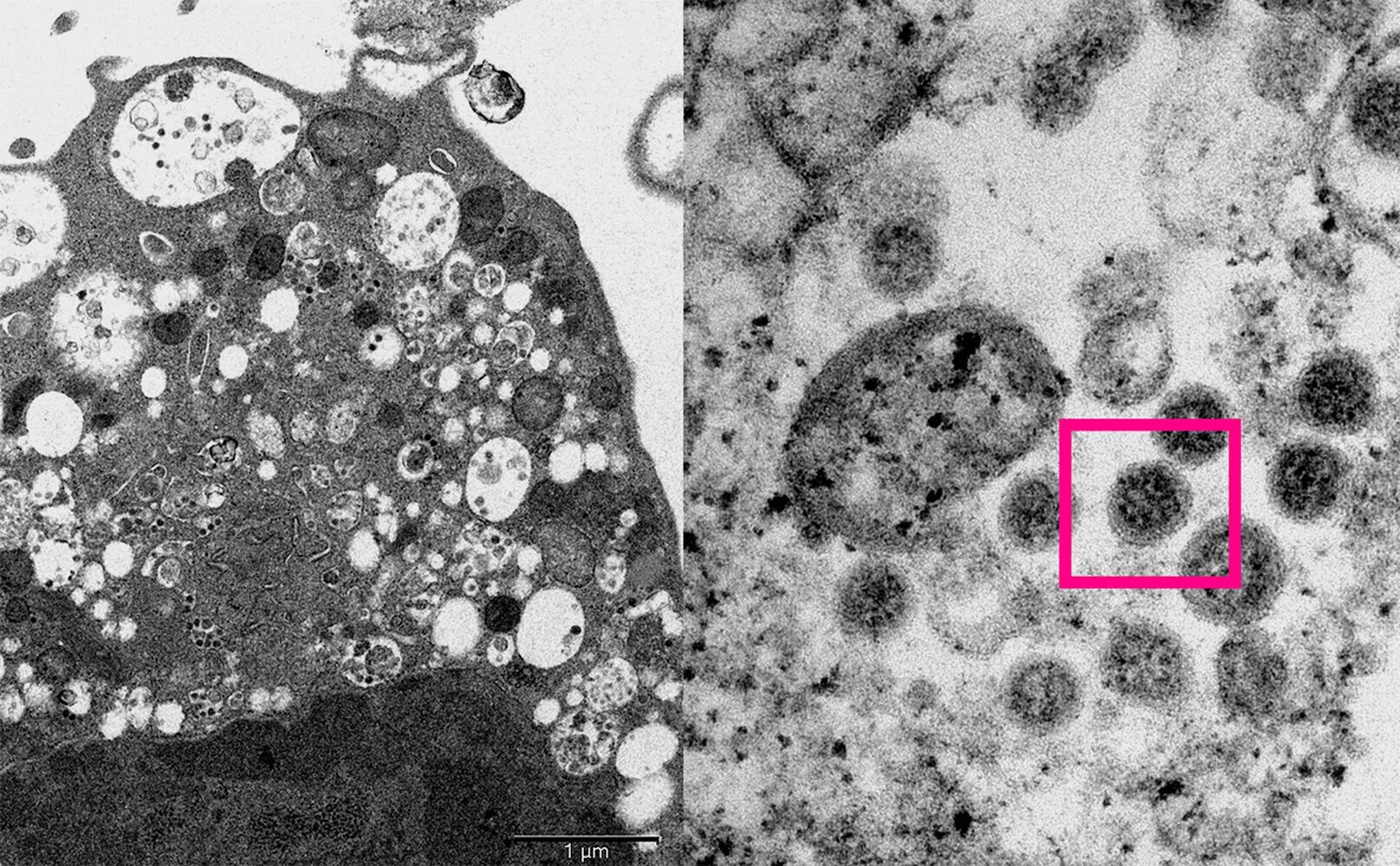 Омикрон-штамм SARS-cov-2. Штаммы коронавируса под микроскопом. Вирус SARS-cov-2 под микроскопом. Вирус коронавируса под микроскопом.