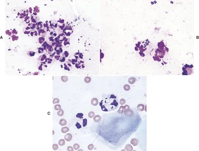 Peptostreptococcus. Пептострептококки микроскопия. Пептострептококки микробиология. Анаэробные стрептококки пептострептококки. Peptostreptococcus anaerobius по Граму.