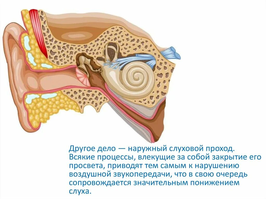 Поражение слухового нерва. Кохлеарный неврит. Кохлеарный неврит барабанная перепонка. Кохлеарный неврит слухового нерва. Неврит слухового нерва симптомы.