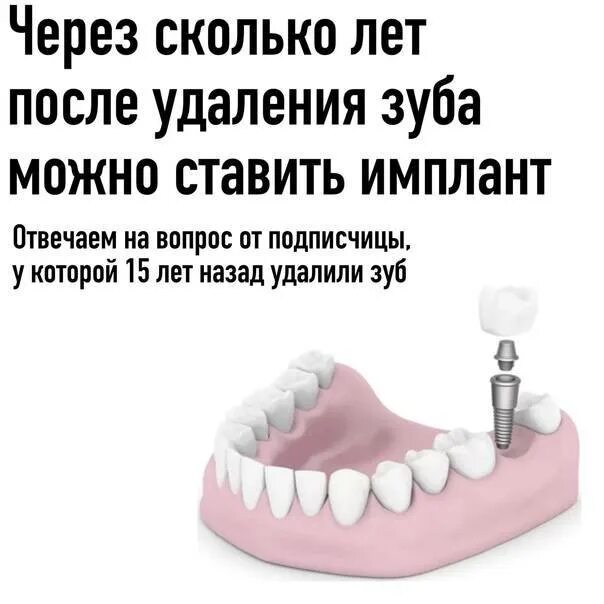 Через какое время после установки