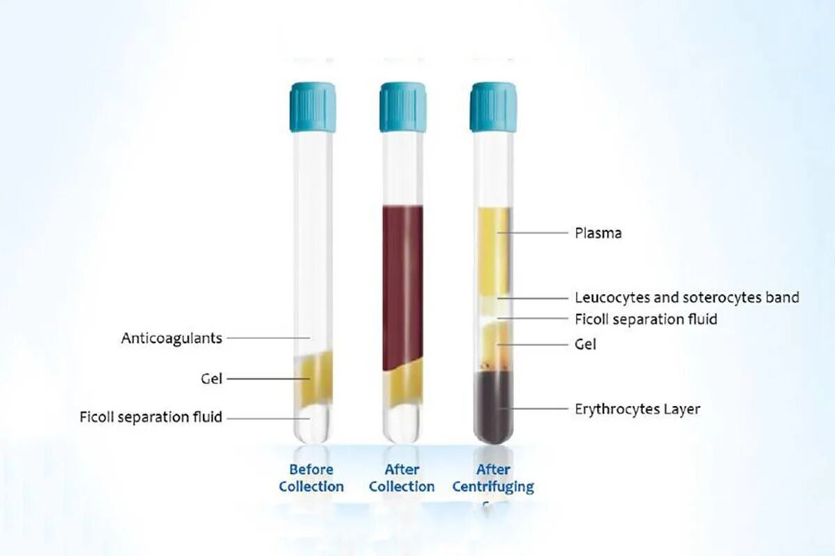 Натрий плазмы норма. Плазма натрия. Физиологический раствор. Концентрация натрия в крови. Пробирки вакуумные с натрий гепарином и гелем 9мл improvacuter.