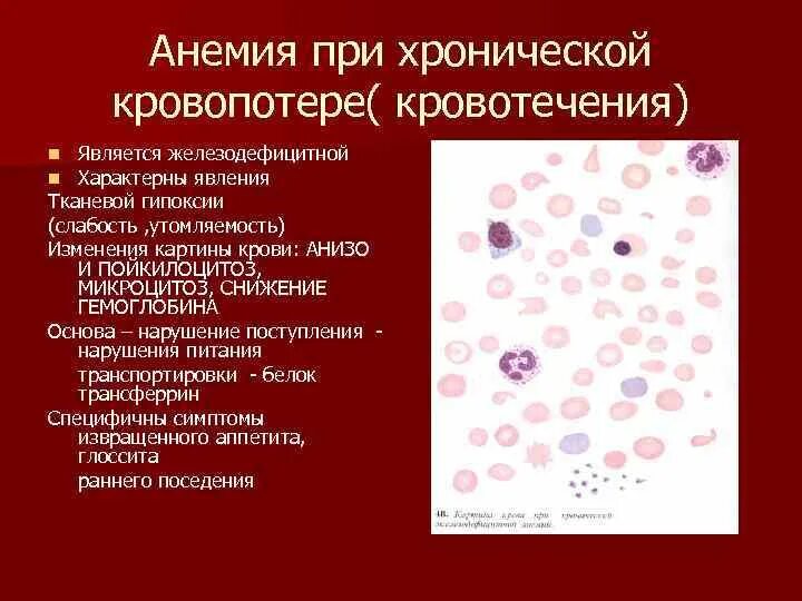 Острая кровопотеря крови. Анемия вследствие хронической кровопотери. Острая постгеморрагическая анемия анализ крови показатели. Постгеморрагическая анемия картина крови. Хроническая железодефицитная анемия показатели эритроцитов.