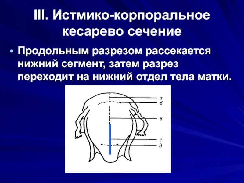 Отклонение профиля продольного сечения. Донное сечение. Донное сечение. Истмико корпоральный разрез. Донное сечение.