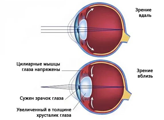 Мышцы аккомодации глаза. Механизм аккомодации хрусталика. Аккомодация хрусталика глаза. Спазм аккомодации глаз. Причины аккомодации