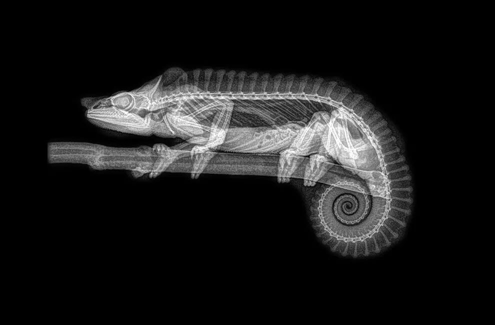 X-ray рентген. Поцелуй рентген. Рентгеновский снимок человека. Рентгеновские снимки. Насквозь прозрачный.