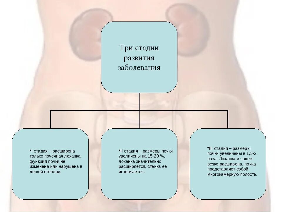 Почки лоханка причины. Гидронефроз левой почки 2ст. Гидронефроз почки патогенез. Гидронефроз этиология.