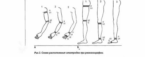 Сегменты конечностей