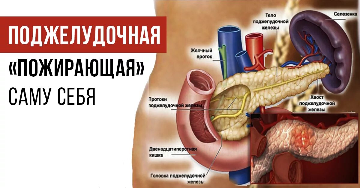 Болезни поджелудочной железы. Поджелудочная железа симптомы заболевания. Нарушение поджелудочной железы.