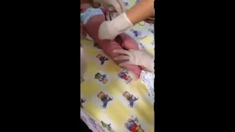 Во сколько лет головка сама откроется
