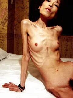 anorexic nudes.