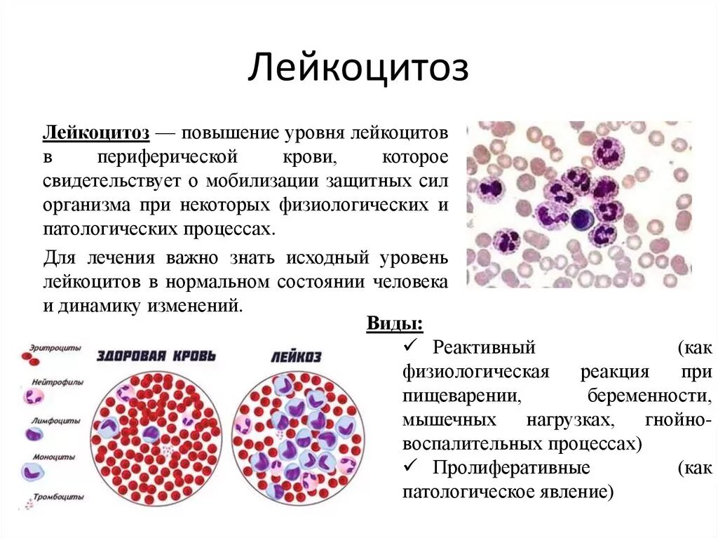 Лейкоциты качественно что это значит. Острый лейкоцитоз крови показатели. Уменьшение содержания в крови нормальных лейкоцитов. Патология крови лейкоцитозы. Болезни при повышении лейкоцитов.