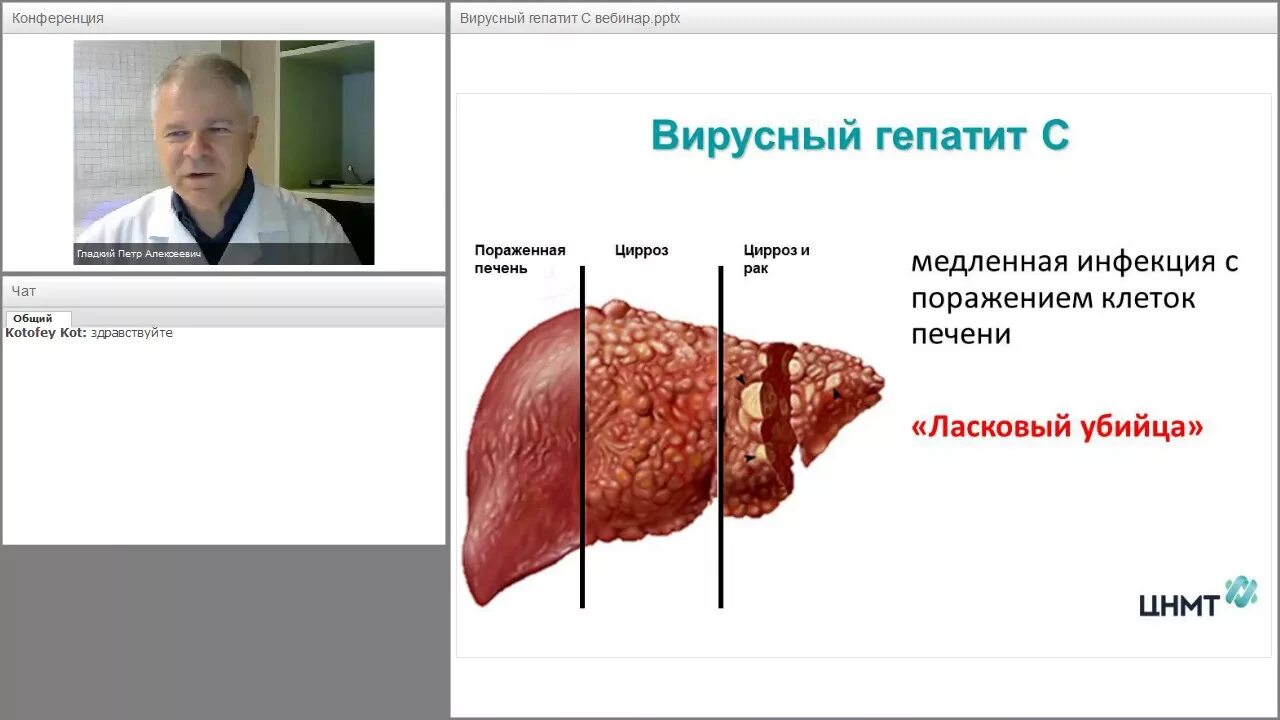 Какой врач лечит гепатит с. Клиника и симптомы гепатита ц. вирусный гепатит внешние проявление. клиника хронического гепатита картинки. вирусный гепатит с ,цирроз печени клиника.
