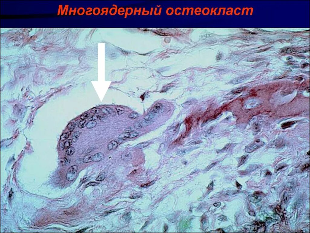 асфиксия инородным телом. причины механической асфиксии. оказание помощи при механической асфиксии. обструкция дыхательных путей. при асфиксии дыхательных путей.