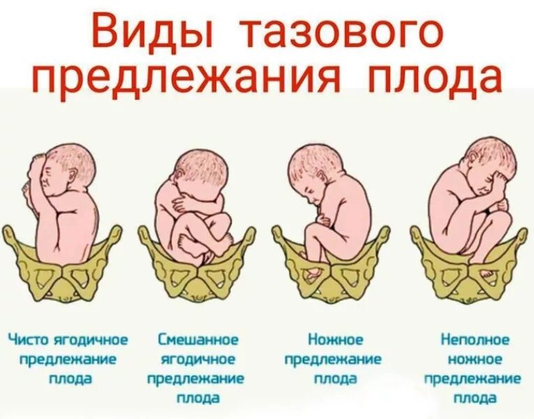 Почему ребенок не сидит в 8 месяцев