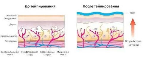 Результаты тейпирования