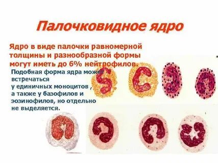 Формы ядра